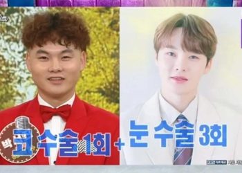 Park Seo Jin Ungkapkan Kesiapan Habiskan Rp1 Miliar untuk Operasi Plastik, Inilah Transformasinya!