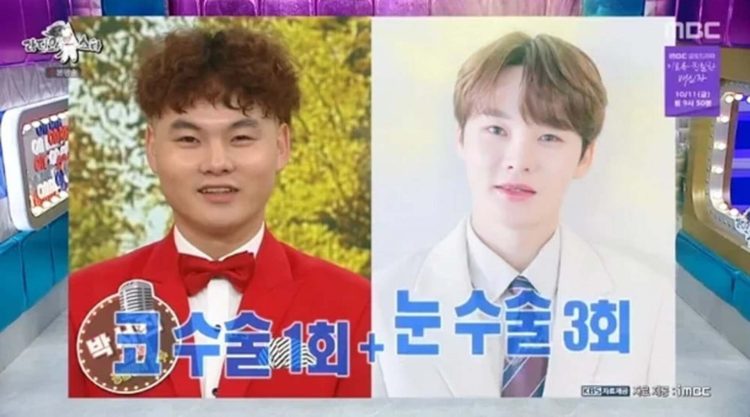 Park Seo Jin Ungkapkan Kesiapan Habiskan Rp1 Miliar untuk Operasi Plastik, Inilah Transformasinya!