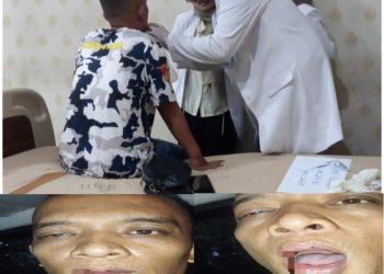 Diduga Aniaya Warga di Gereja, Mahasiswa Teologi Dilaporkan ke Polisi di Bandar Lampung